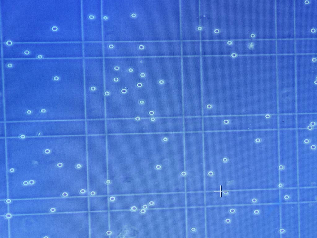 Accurate-Cell-counting-using-a-Hemocytometer