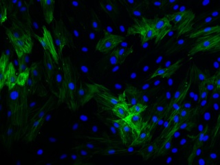 Diseased Bronch. Sm. Muscle Cells (COPD)