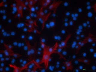 Diseased Bronchial Smooth Muscle-Asthma