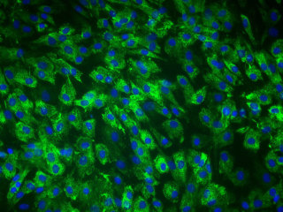 NHDF-Ad-Der Fibroblasts FGM-2, cryo amp