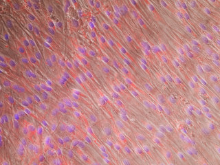 NHLF-Lung Fibroblasts FGM-2, cryo amp