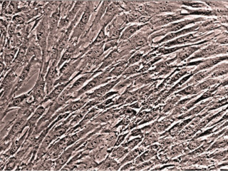 Mesenchymal Stem Cells cryo amp
