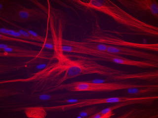 HSMM – Human Skeletal Muscle Myoblasts