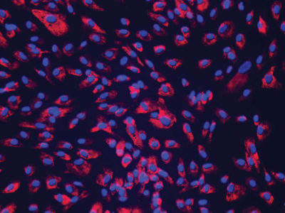 NHCF-V – Human Ventricular Cardiac Fibroblasts